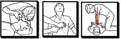 cpr cpr